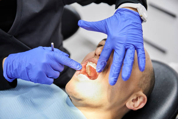 Best Urgent Care for Lost Fillings or Crowns in Sault Ste Marie, MI